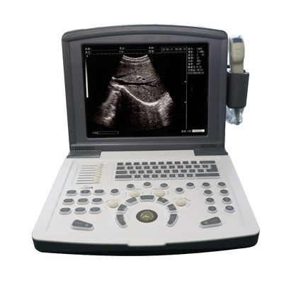 Máy quét siêu âm chẩn đoán kỹ thuật số đầy đủ OEM