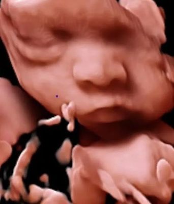 Máy quét siêu âm xe đẩy siêu âm 3D 4D 5D màu cho OB GYN